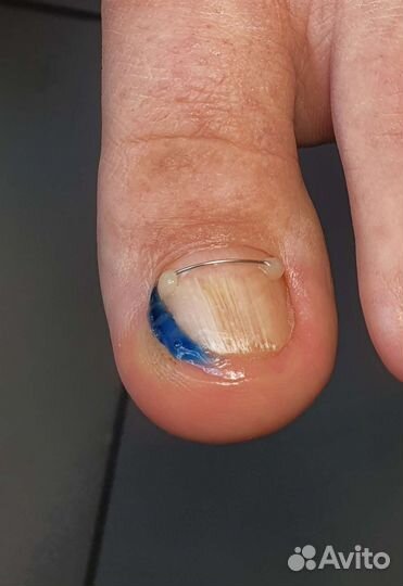 Подолог,медицинский педикюр, маникюр, SMART