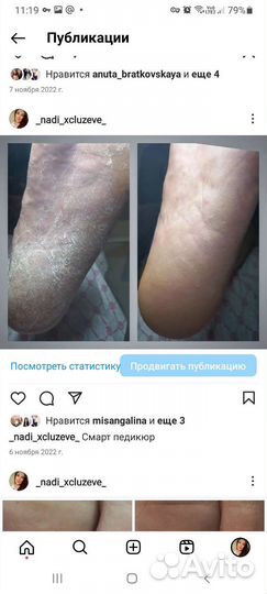 Наращивание ногтей