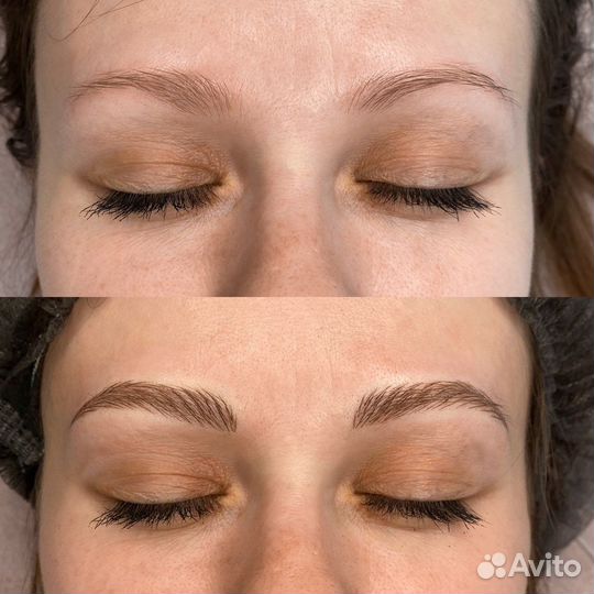 Микроблейдинг