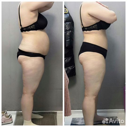 LPG массаж всего тела коррекция фигуры модель