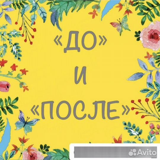 Электроэпиляция женская