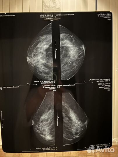 Рентгеновские снимки. 16 штук