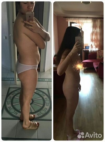 Антицеллюлитный массаж