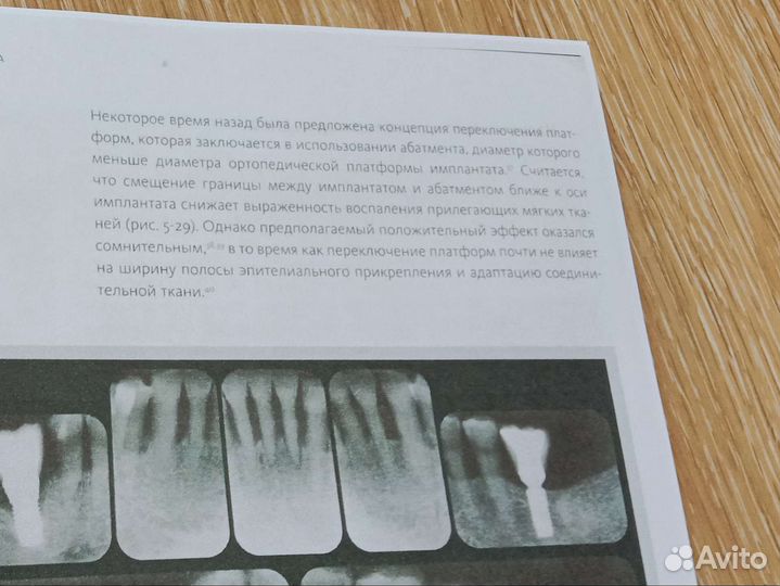 Периимплантит