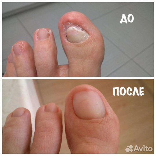 Услуги подолога