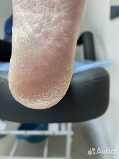 Ногти гель лак