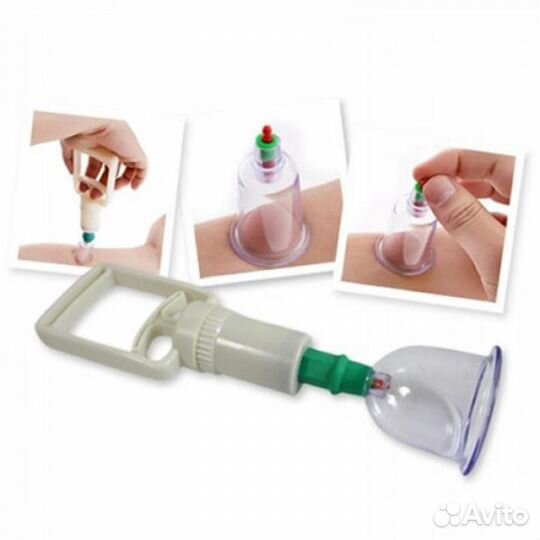 Вакуумные банки хиджама