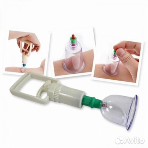 Вакуумные банки хиджама