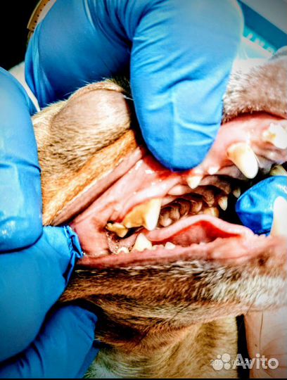 Ультразвуковая чистка зубов без стресса