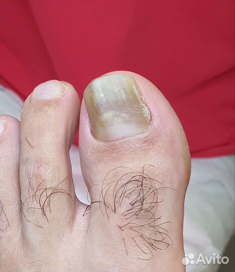 Подолог,медицинский педикюр, маникюр, SMART