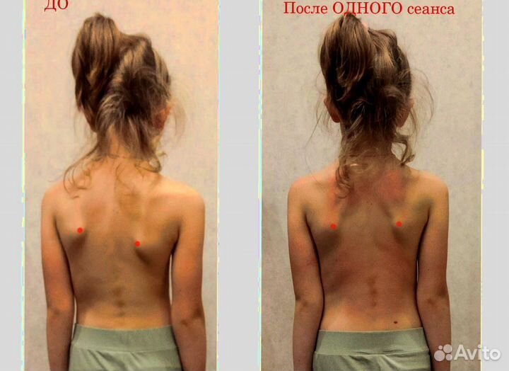 Мануальный Массаж. Костоправ. Без Боли