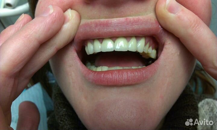 Услуги зубного техника