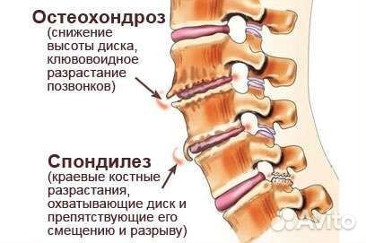 Лечебно-оздоровительный Массаж На дому