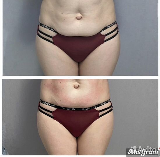 Коррекция фигуры