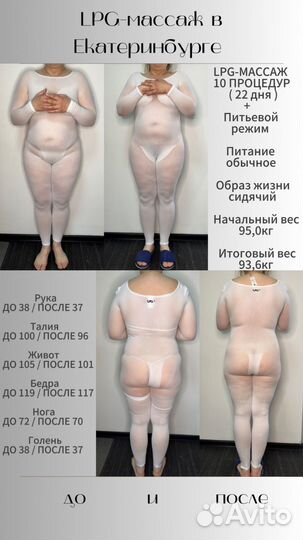 LPG-массаж на оригинальном оборудовании