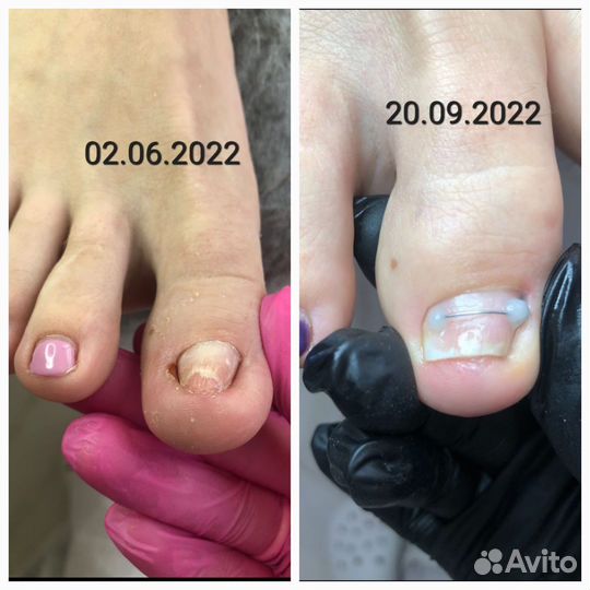 Подолог, педикюр, маникюр