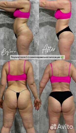 Массаж, коррекция фигры, СПА