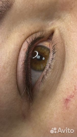 Татуаж, лазерное удаление татуажа и тату