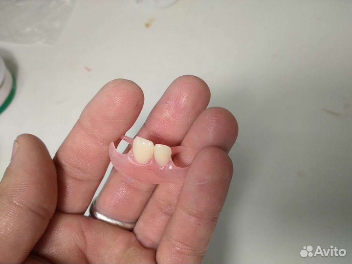 Изготовление и ремонт, съемных протезов