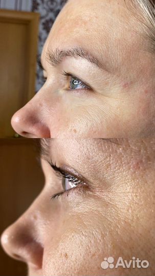 Ламинирование ресниц