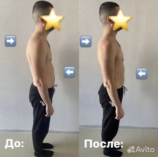 Кинезиолог. ЛФК. Массаж. Коррекция осанки