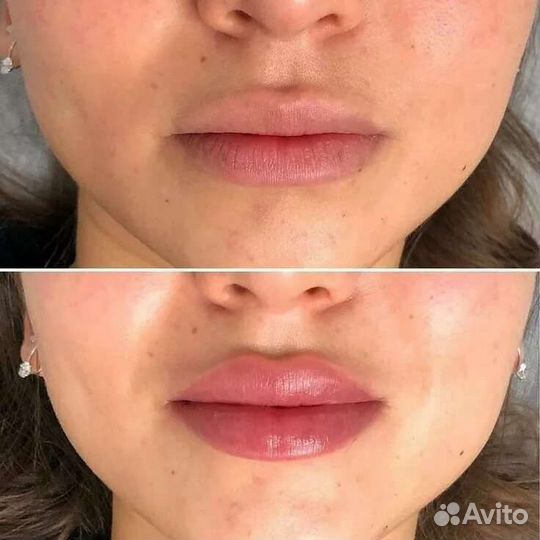 Косметолог на дому