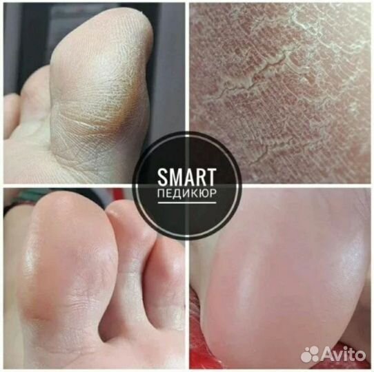 Педикюр с покрытием