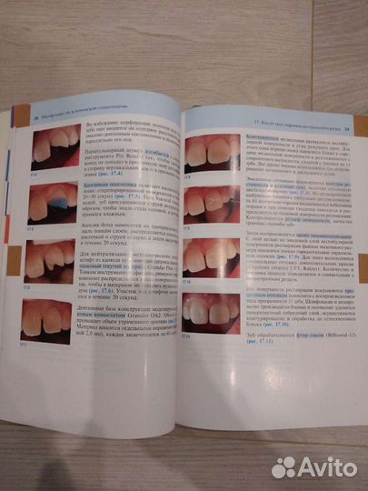 Мастер класс по эстетической стоматологии