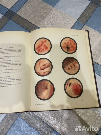 Фрумкин: Цистоскопический атлас 1954г