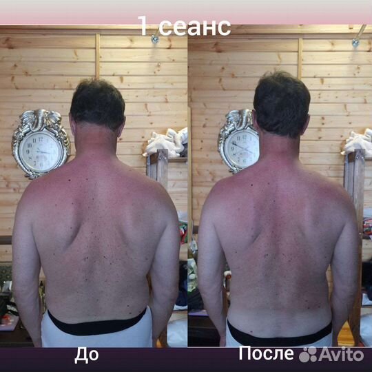 Костоправ. Владимир