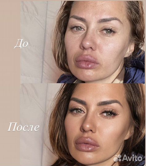 Ретушь фотографий обработка фото