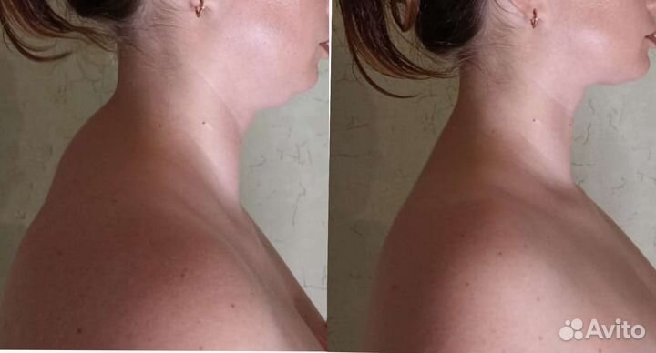 Массаж липопластика лица и тела