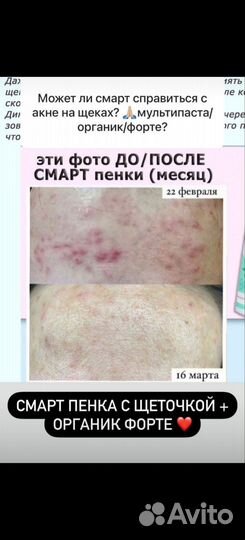 Пенка для лица