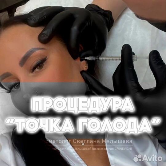 Увеличение губ, косметолог