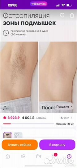 Фотоэпилятор