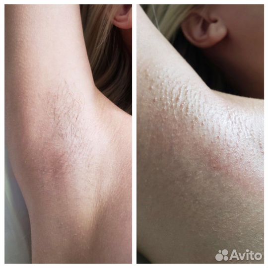 Мастер шугаринга