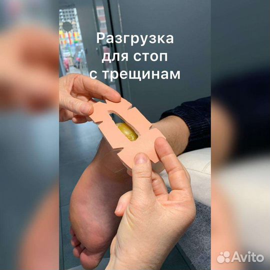 Лечебный педикюр,подолог