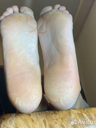 Педикюр любой сложности, вросший ноготь вс,подолог