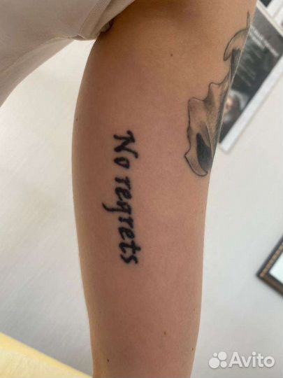 Удаление татуировок, татуажа