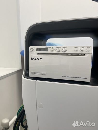 Узи аппарат samsung HS-40