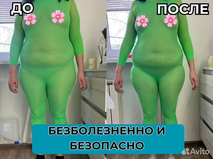 Аппаратный массаж / Массаж лпг / LPG