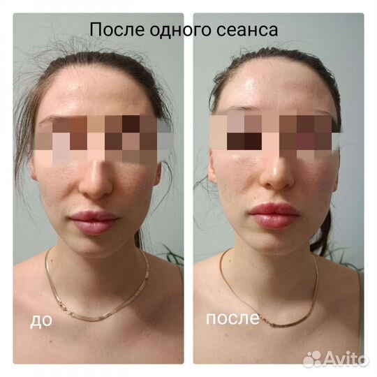 Массаж лица