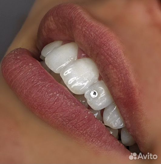 Скайсы и обучение установки скайсам