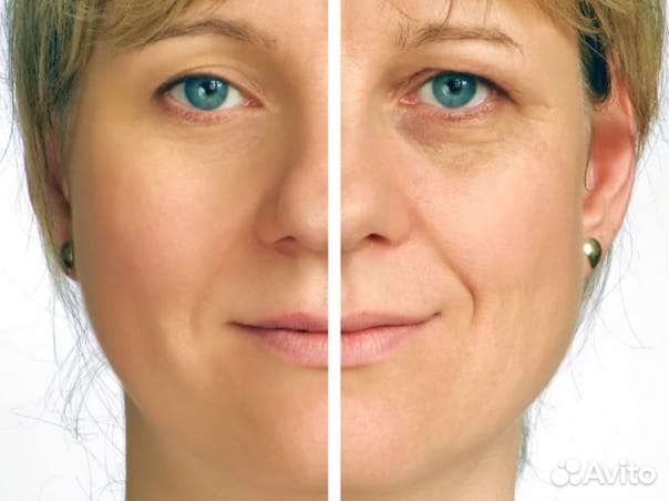 Холодная плазма