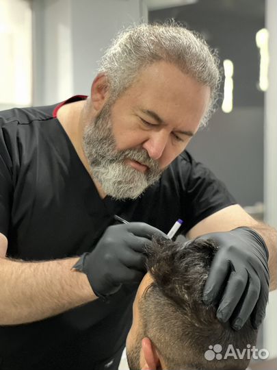 Консультация перед пересадкой волос