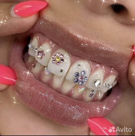 Установка скайсов