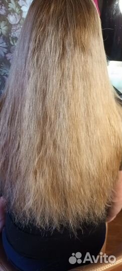 Лазерное восстановление волос от выпадения