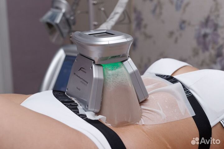 Криолиполиз