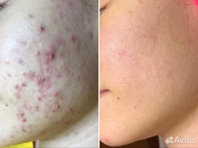 Косметолог с мед. образованием