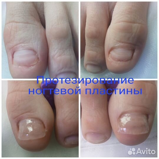 Мастер педикюра, подолог